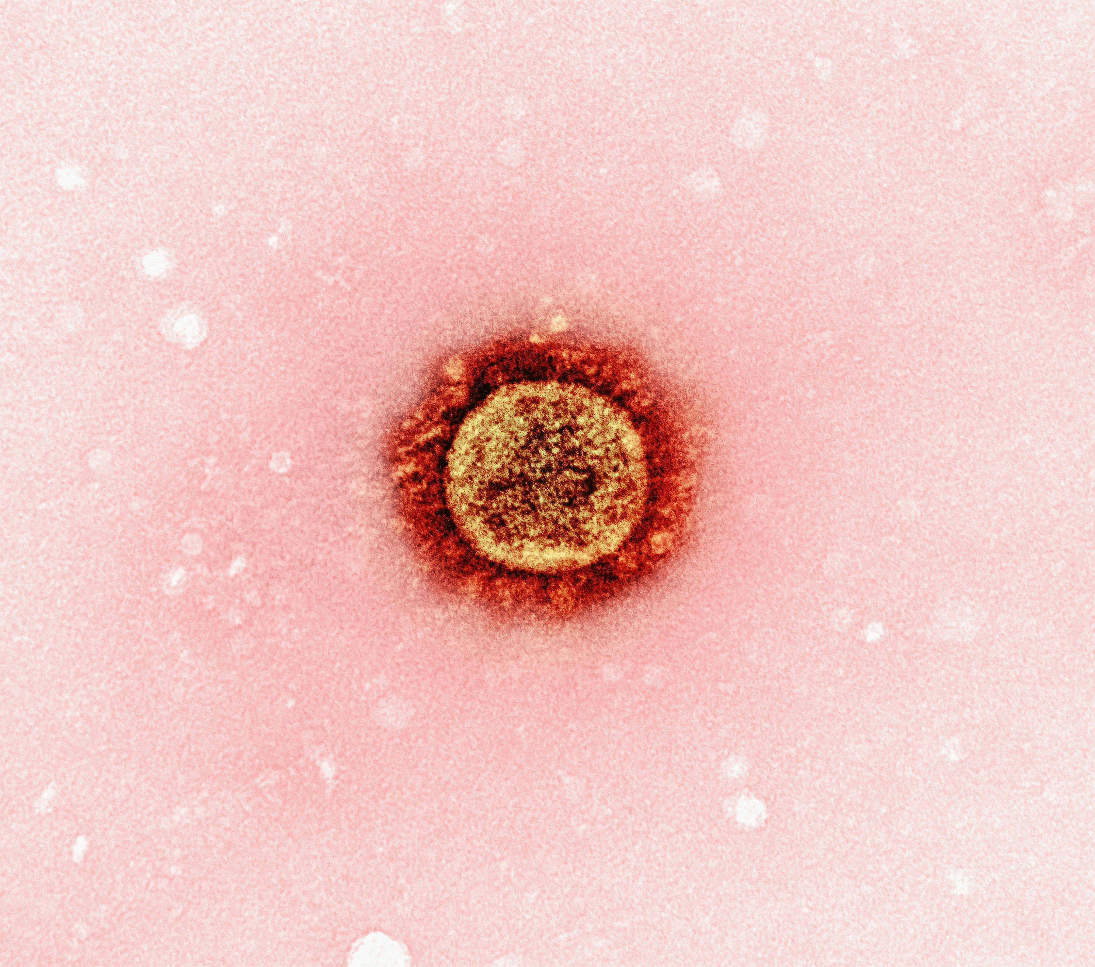 WHO Estimates 82.4 Million New Gonorrhoea Cases Globally in 2020