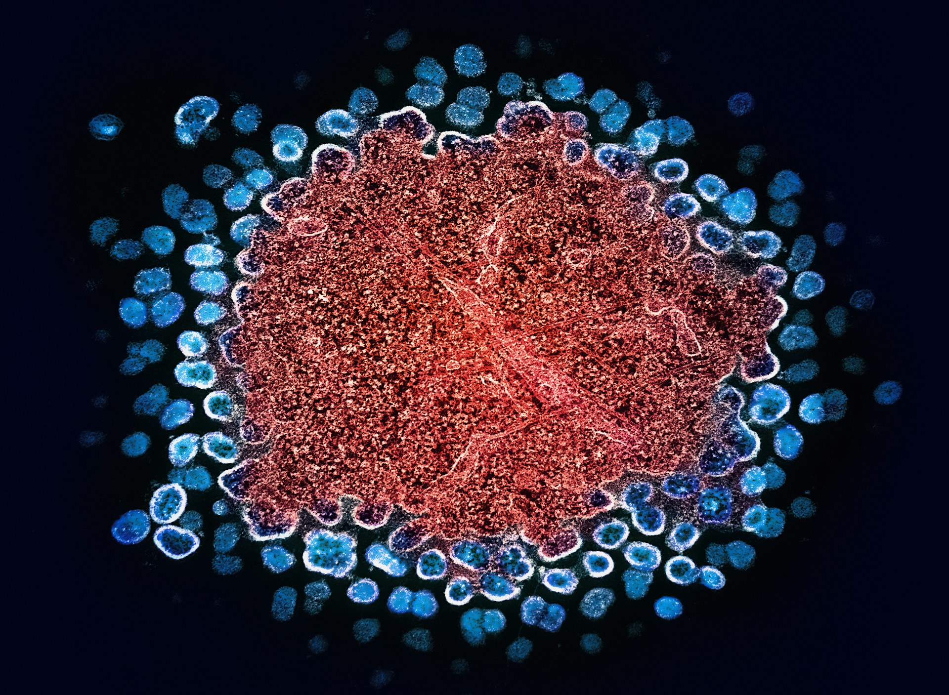 HIV Capsid Confirmed as Drug Target Despite Resistance