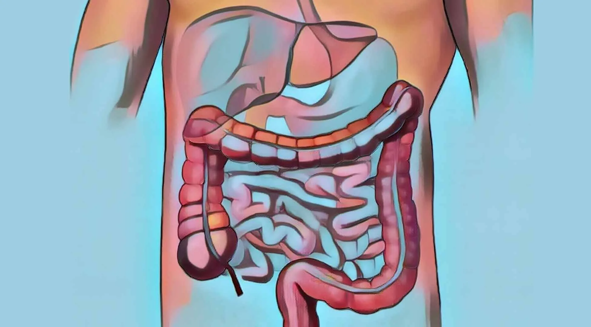 Rising Irritable Bowel Syndrome in Children