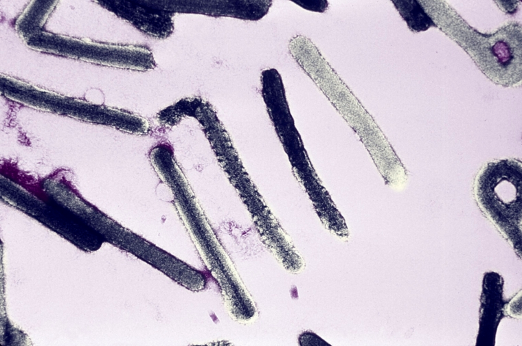 WHO Confirms New Marburg Virus Disease Case in Uganda