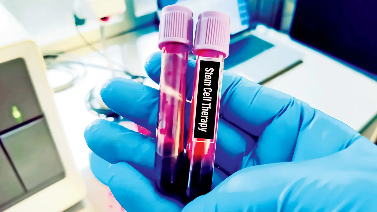 Unproven Stem Cell Therapy for Autism Treatment